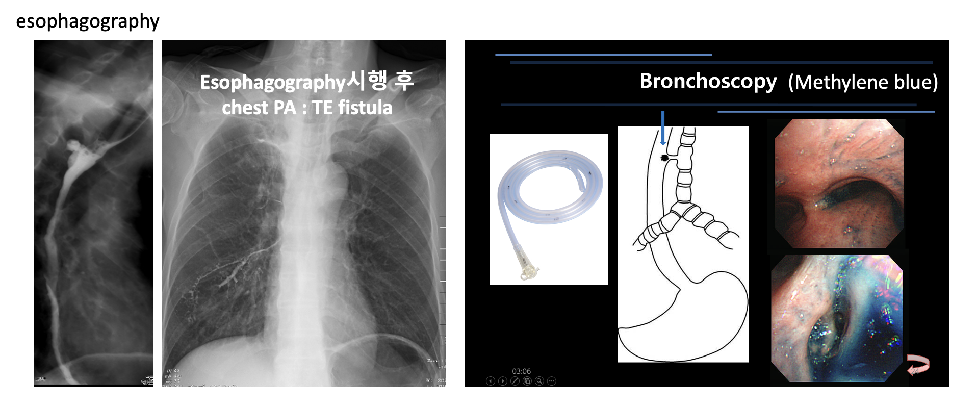 엑스레이 필름, 텍스트, 의료 영상, 방사선과이(가) 표시된 사진
자동 생성된 설명