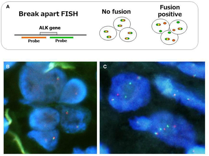 ALK FISH  :에 대한 이미지 검색결과